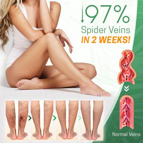 SkinVault™ Varicose Vein Repair Cream