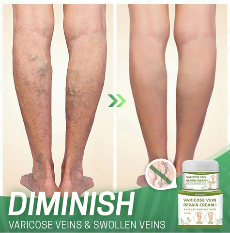 SkinVault™ Varicose Vein Repair Cream