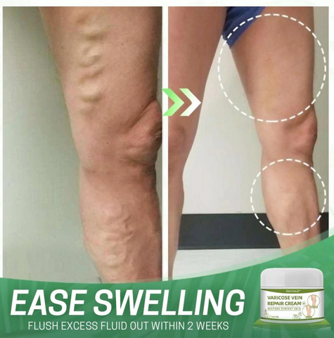 SkinVault™ Varicose Vein Repair Cream