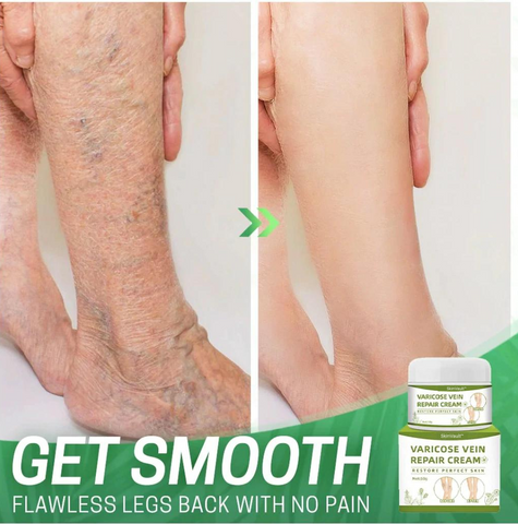 SkinVault™ Varicose Vein Repair Cream